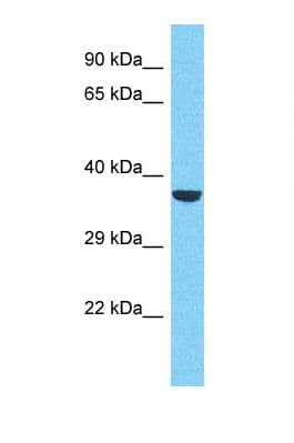 RBM43 Antibody (aa62-111)
