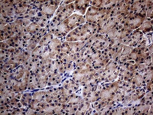 ITGB1 / Integrin Beta 1 / CD29 Antibody (clone OTI9B5)