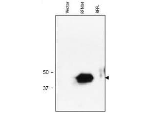 IHC-plus™ Polyclonal Rabbit anti-Human RNF34 Antibody (IHC, IF, WB)