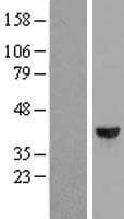 DCPS Protein (Over-Expression Lysate Myc-DDK (Flag))