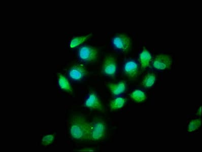 Polyclonal Rabbit anti-Human MOB1B / MOBKL1A Antibody (aa2-216, WB)