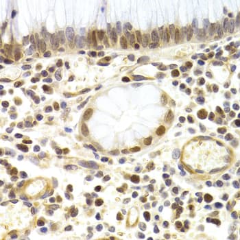 Polyclonal Rabbit anti-Human MCM4 Antibody (IHC, WB)