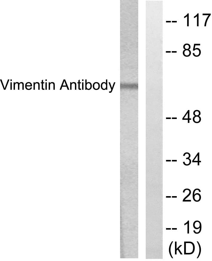 Polyclonal Rabbit anti-Human Vimentin Antibody (aa411-460, IHC, WB)
