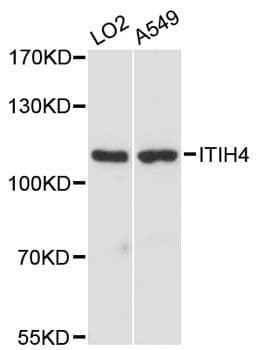 ITIH4 Antibody (aa689-930)