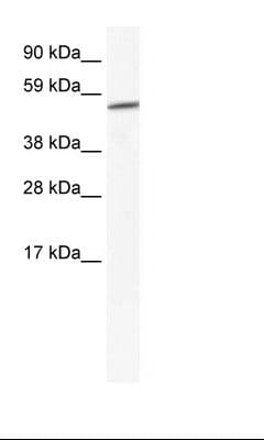 GPC3 / Glypican 3 Antibody (aa324-373)