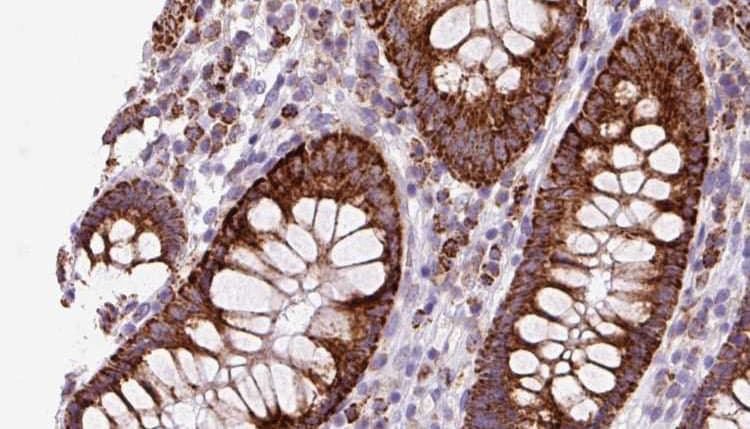 TMEM67 Antibody