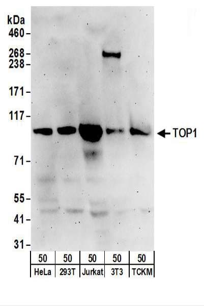 IHC-plus™ TOP1 / Topoisomerase I Antibody (aa715-765)