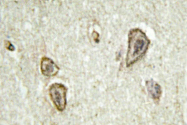 Rhodopsin Kinase / GRK1 Antibody (Ala17)