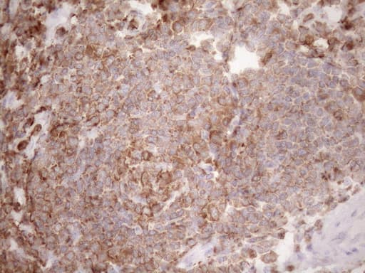 URP2 / FERMT3 Antibody (aa259-528, clone OTI2G2)