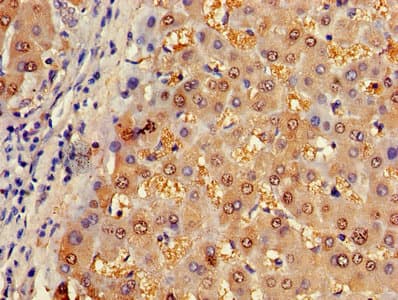 ASL / Argininosuccinate Lyase Antibody