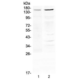 ABCB1 / MDR1 / P Glycoprotein Antibody