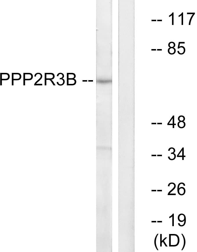 PPP2R3B Antibody (aa364-413)