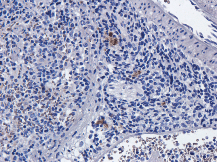 IL2RA / CD25 Antibody (IL-2R alpha (CD25), clone Basiliximab)