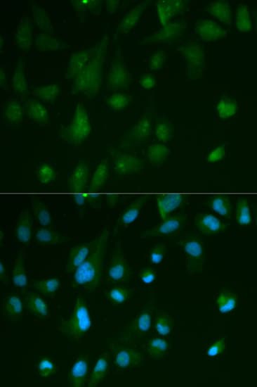 Polyclonal Rabbit anti-Human ARRB1 / Beta Arrestin 1 Antibody (IHC, IF, WB)