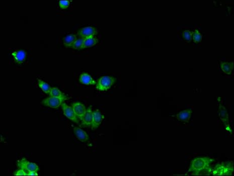 Polyclonal Rabbit anti-Human ALDOC / Aldolase C Antibody (IHC, IF, WB)