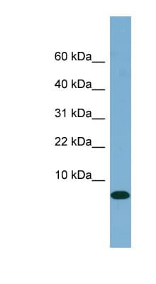 FABP1 / L-FABP Antibody (N-Terminus)
