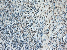 TRIM33 / TIF1-Gamma Antibody (clone OTI9D4)