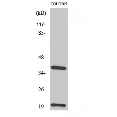 TCR Beta Antibody (Internal)