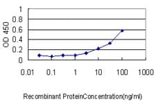 IHC-plus™ Monoclonal Mouse anti-Human JUP/CTNNG/Junction Plakoglobin Antibody (clone 2G9, IHC, IF, WB)