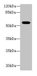 ALDH1A1 / ALDH1 Antibody