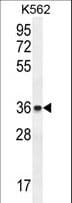 ETV2 Antibody (aa62-90)