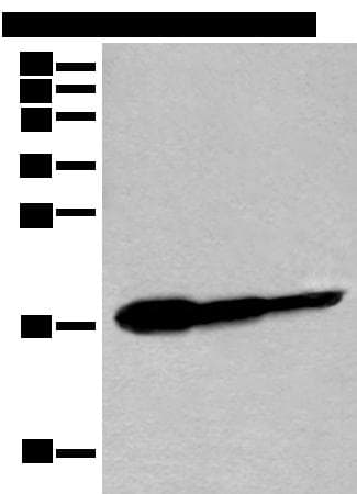 Polyclonal Rabbit anti-Human UEV1 / UEV1A Antibody (IHC, WB)