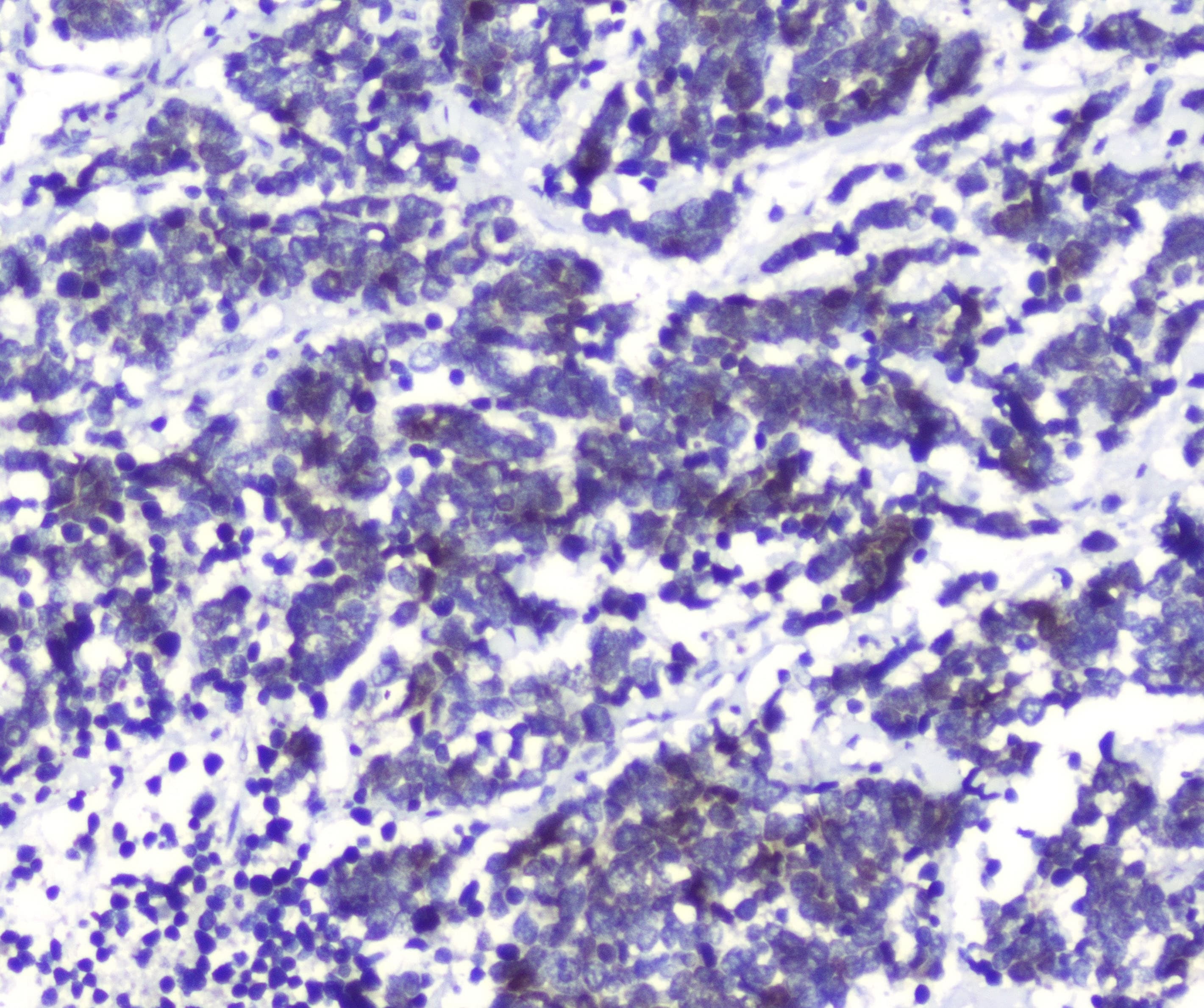 DCK / Deoxycytidine kinase Antibody