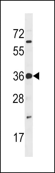 Polyclonal Rabbit anti-Human PRPK / TP53RK Antibody (aa220-249, IHC, WB)