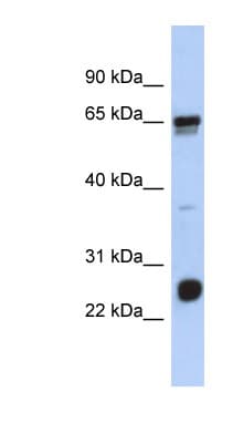 LRIF1 / RIF1 Antibody (aa35-84)