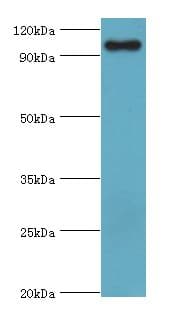 Trimethylguanosine Synthase 1 Antibody (aa714-853)