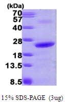 Human NOLA2 Protein (Recombinant His)