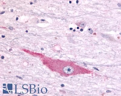 PathPlus™ DUSP22 / JSP 1 Antibody (Internal)