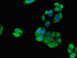 RPS21 / Ribosomal Protein S21 Antibody