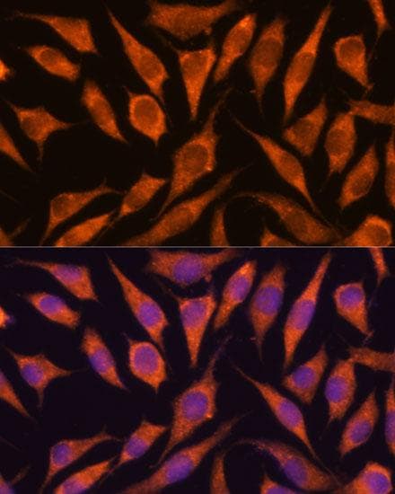 RPAP3 / FLJ21908 Antibody