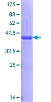 Human DACT1 / DAPPER Protein (Recombinant GST, N-terminus)