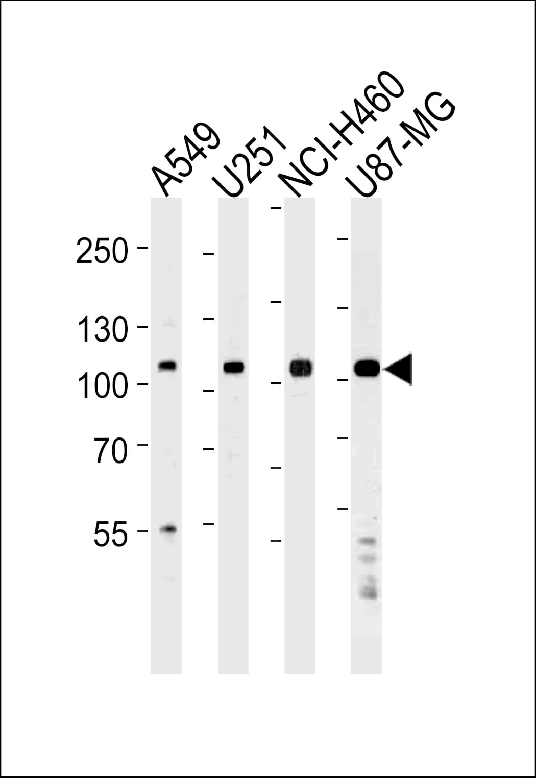 ZNF41 Antibody (aa12-40)