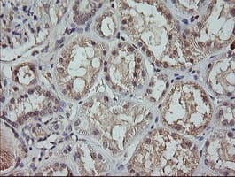 MAP2K3 / MEK3 / MKK3 Antibody (clone OTI5C7, Carrier-free)