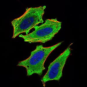 MLXIPL / CHREBP Antibody (aa18-143, clone 5D12D1)