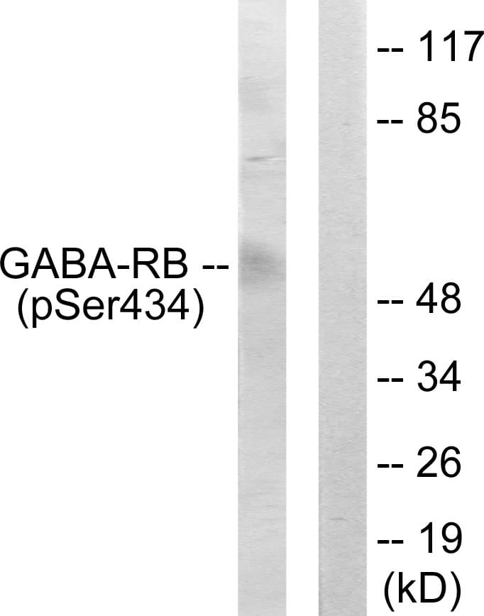 GABRB1 Antibody (phospho-Ser434)