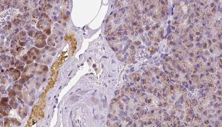 MYHC / MYH6 Antibody