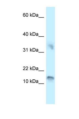 Polyclonal Rabbit anti-Human UTS2B / U2B Antibody (C-Terminus, WB)