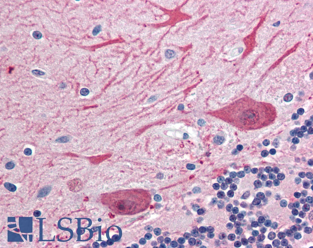 IHC-plus™ STX2 / Syntaxin 2 Antibody (aa1-19)