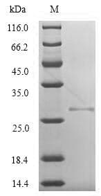 Vaccinia Virus K3L/VACWR034 Protein (Recombinant 6His-SUMO, N-terminus)