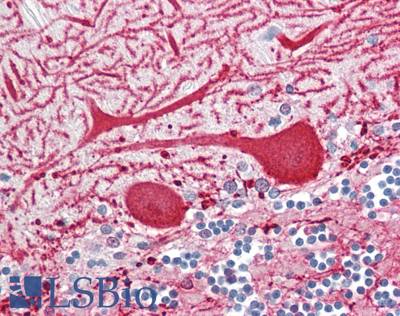 IHC-plus™ Polyclonal Rabbit anti-Human GBP4 / Mpa2 Antibody (aa551-600, IHC)