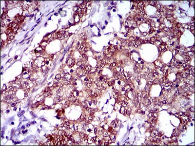 CFLAR / FLIP Antibody (aa100-251, clone 6G11A6)