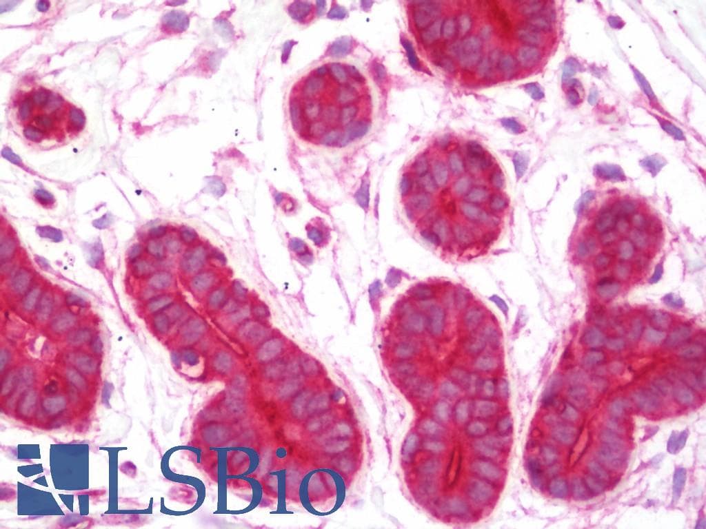IHC-plus™ Monoclonal Rabbit anti-Human RALA / RAL Antibody (clone EPR6468, Internal, IHC, WB)