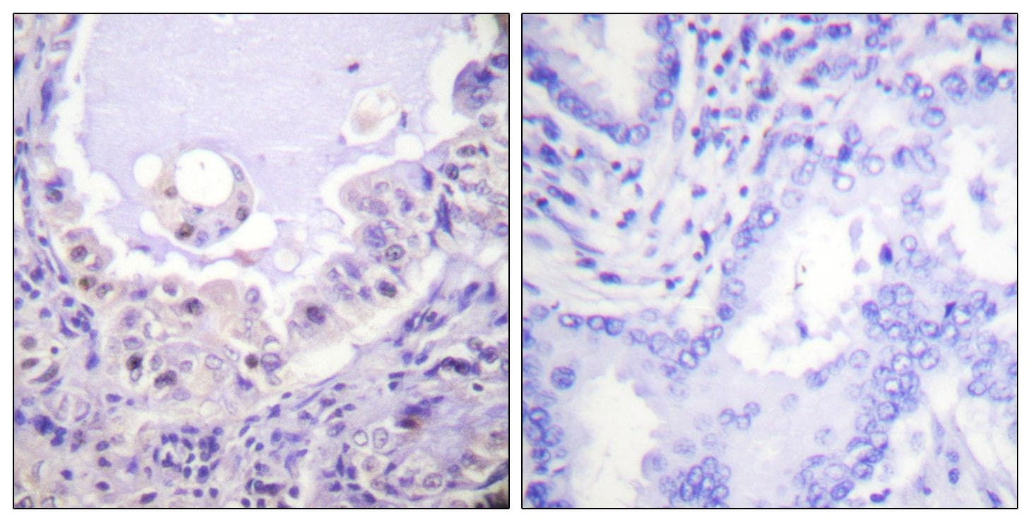 RAF1 / RAF Antibody (p621)