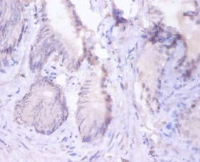 PSMB4 Antibody