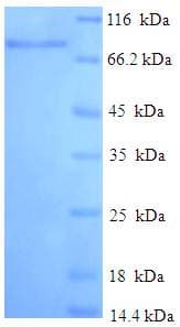 Human IFIT3 Protein (Recombinant His-SUMO)
