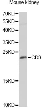 Polyclonal Rabbit anti-Human CD9 Antibody (IHC, WB)